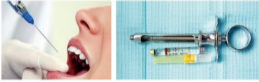 胰島素，牙科麻醉6.png